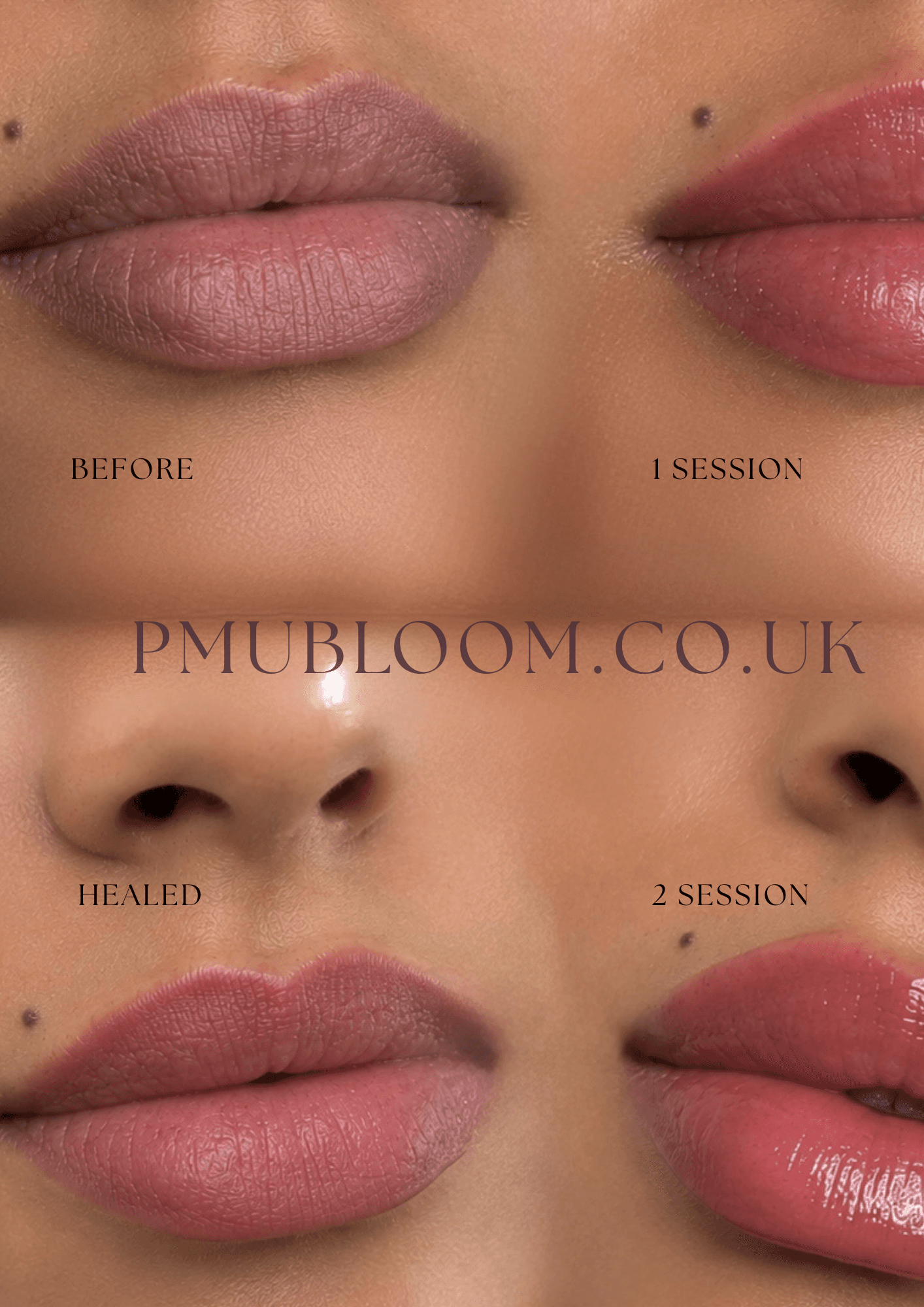 Lip Neutralisation
